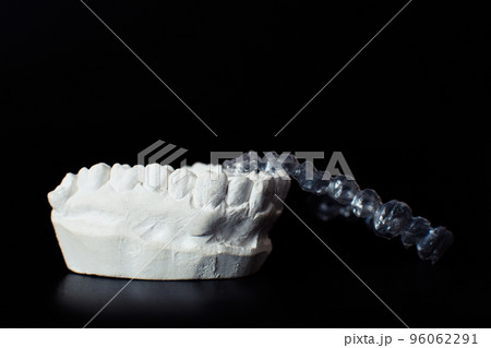 Dental jaw model over black background. Transparent invisible dental aligners or braces aplicable for an orthodontic dental treatment 96062291