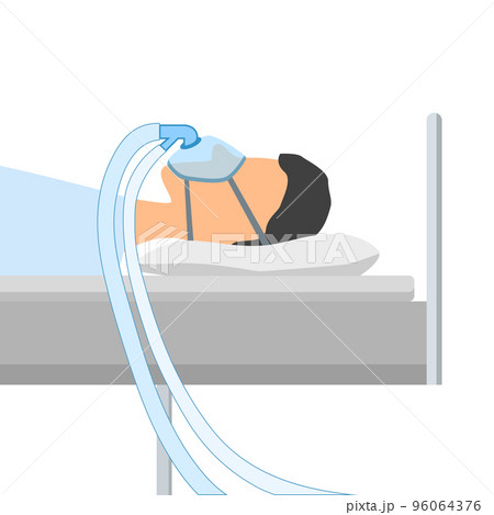 A man lies on a bed with a mask for artificial ventilation of the lungs from coronavirus disease. CPAP. Oxygen mask with two tubes. Flat cartoon illustration. Isolated vector EPS10. 96064376