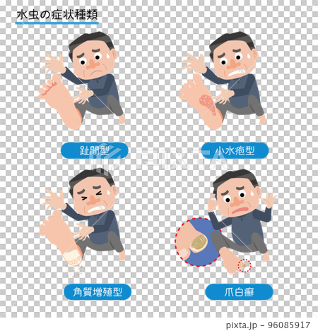 一個被腳氣症狀困擾的男人 96085917