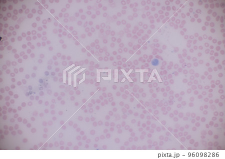Tissue of Blood human, Vein human, Artery human and Heart muscle human under the microscope in Lab. 96098286