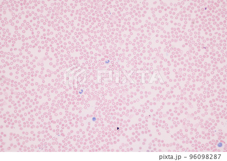 Tissue of Blood human, Vein human, Artery human and Heart muscle human under the microscope in Lab. Tissue of Blood human, Vein human, Artery human and Heart muscle human under the microscope in Lab. 96098287