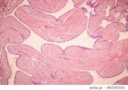 Tissue of Blood human, Vein human, Artery human and Heart muscle human under the microscope in Lab. 96098300