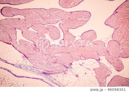 Tissue of Blood human, Vein human, Artery human and Heart muscle human under the microscope in Lab. Tissue of Blood human, Vein human, Artery human and Heart muscle human under the microscope in Lab. 96098301