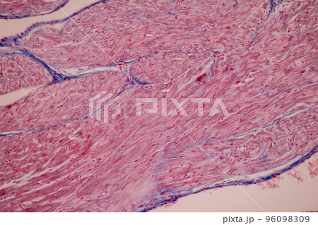 Tissue of Blood human, Vein human, Artery human and Heart muscle human under the microscope in Lab. Tissue of Blood human, Vein human, Artery human and Heart muscle human under the microscope in Lab. 96098309