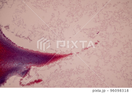 Tissue of Blood human, Vein human, Artery human and Heart muscle human under the microscope in Lab. Tissue of Blood human, Vein human, Artery human and Heart muscle human under the microscope in Lab. 96098318
