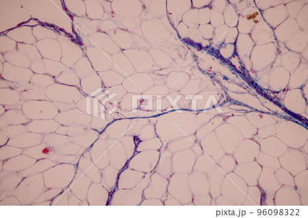 Tissue of Blood human, Vein human, Artery human and Heart muscle human under the microscope in Lab. Tissue of Blood human, Vein human, Artery human and Heart muscle human under the microscope in Lab. 96098322