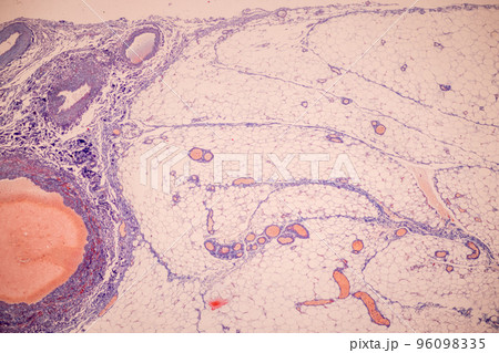 Tissue of Blood human, Vein human, Artery human and Heart muscle human under the microscope in Lab. Tissue of Blood human, Vein human, Artery human and Heart muscle human under the microscope in Lab. 96098335