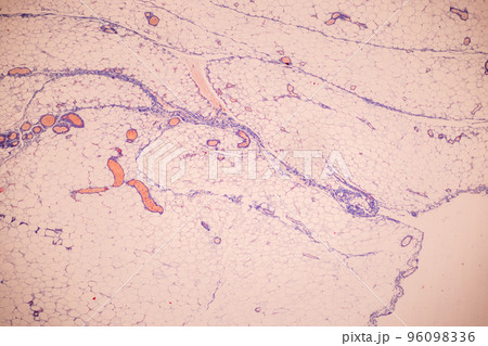 Tissue of Blood human, Vein human, Artery human and Heart muscle human under the microscope in Lab. Tissue of Blood human, Vein human, Artery human and Heart muscle human under the microscope in Lab. 96098336