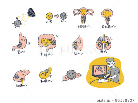 がんになった臓器の親しみやすいイラスト 96158507