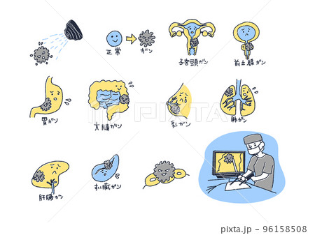 がんになった臓器の親しみやすいイラスト 96158508