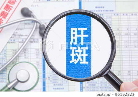 肝斑 医療イメージ 肝斑 医療イメージ 96192823