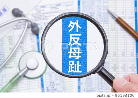 外反母趾　医療イメージ 96193106