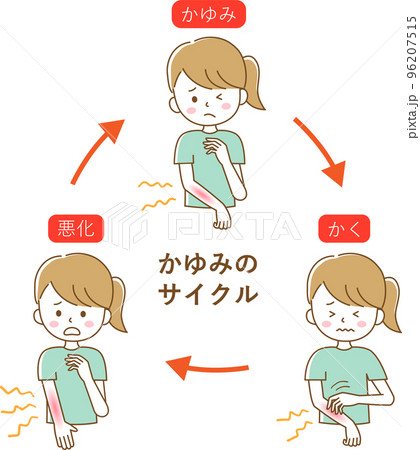 かゆみのサイクル　女性 96207515