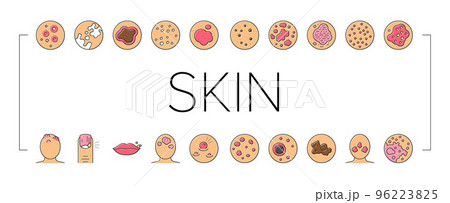 Skin Disease Symptom Collection Icons Set Vector . 96223825