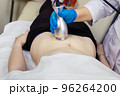 Radio frequency tummy tuck. Anti-cellulite massage with cavitation and RF lifting apparatus. 96264200