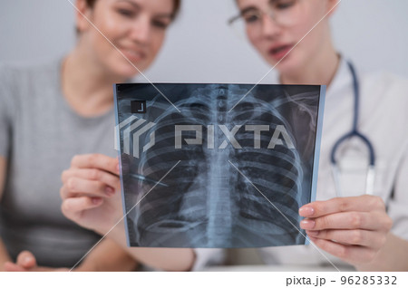 The doctor consults a caucasian woman and comments on the x-ray of the lungs.  96285332