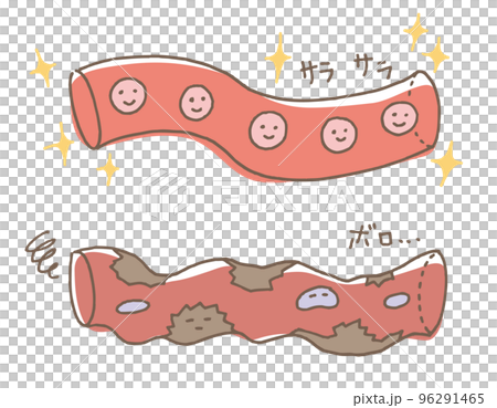 健康な血管　錆びた血管（線画別カラー） 96291465