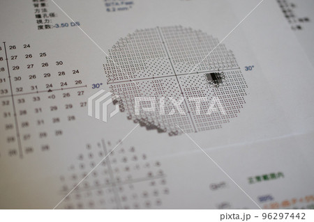 緑内障の検査結果のクローズアップ 96297442