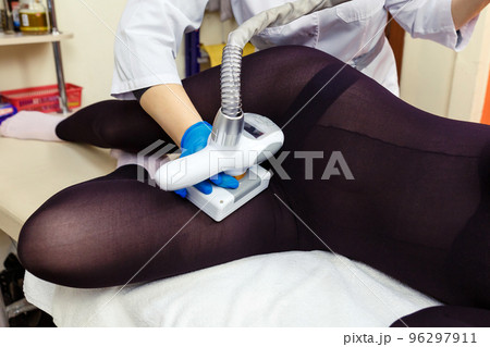 Anti-cellulite massage procedure in the cosmetologist's office. LPG massage for slender and beautiful women's legs. Anti-cellulite massage procedure in the cosmetologist's office. LPG massage for slender and beautiful women's legs. 96297911