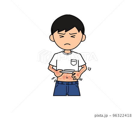 発疹 96322418