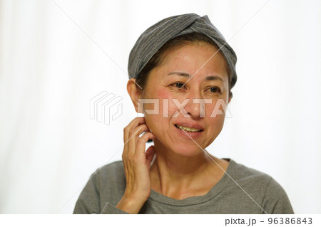 顔に吹き出物、赤みが出た中年女性　 96386843