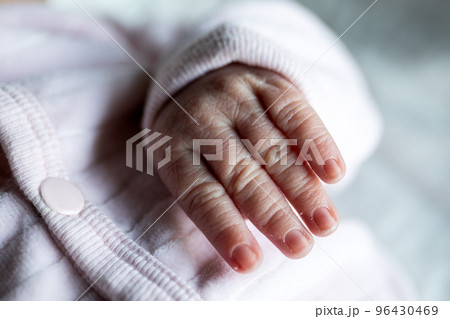 Newborn's hand. fingers, nails and peeling dry skin 96430469
