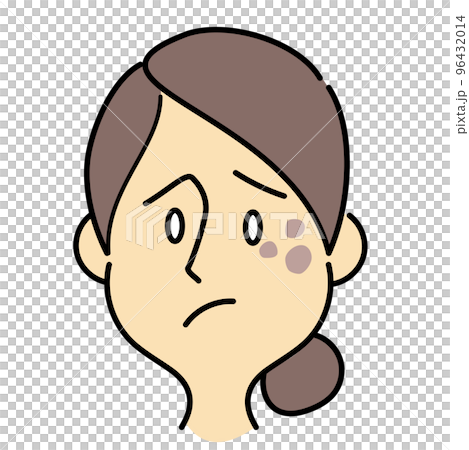 Bun hair women's skin trouble Bun hair women's skin trouble 96432014