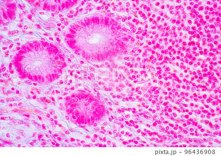 Backgrounds of Characteristics Tissue of Stomach Human, Small intestine Human, Pancreas Human and Large intestine Human under the microscope in Lab. 96436908