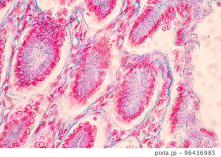 Backgrounds of Characteristics Tissue of Stomach Human, Small intestine Human, Pancreas Human and Large intestine Human under the microscope in Lab. 96436985