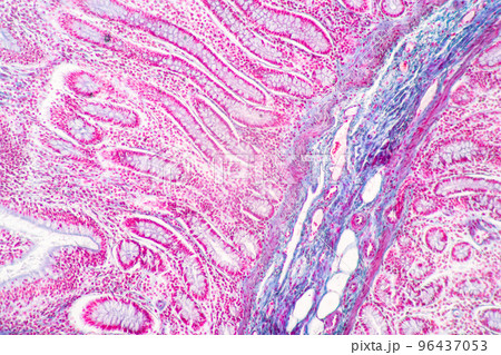 Backgrounds of Characteristics Tissue of Stomach Human, Small intestine Human, Pancreas Human and Large intestine Human under the microscope in Lab. Backgrounds of Characteristics Tissue of Stomach Human, Small intestine Human, Pancreas Human and Large intestine Human under the microscope in Lab. 96437053