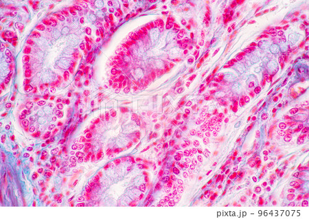 Backgrounds of Characteristics Tissue of Stomach Human, Small intestine Human, Pancreas Human and Large intestine Human under the microscope in Lab. 96437075
