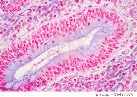 Backgrounds of Characteristics Tissue of Stomach Human, Small intestine Human, Pancreas Human and Large intestine Human under the microscope in Lab. 96437076