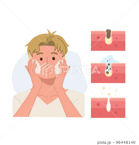 Facial care, skin defects, skin problems, acne, facials. Face Care man concept. Step of remove acne. Vector illustration. 96448140