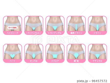 VIO脱毛  女性が気になるアンダーヘアのデザイン 3DCGイラスト 96457572