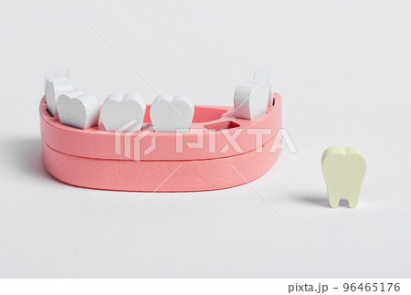 Wooden jaw model and fallen out bad tooth with plaque, cavity. Teeth diseases, inflammation, poor oral hygiene concept. Children game at dentist 96465176