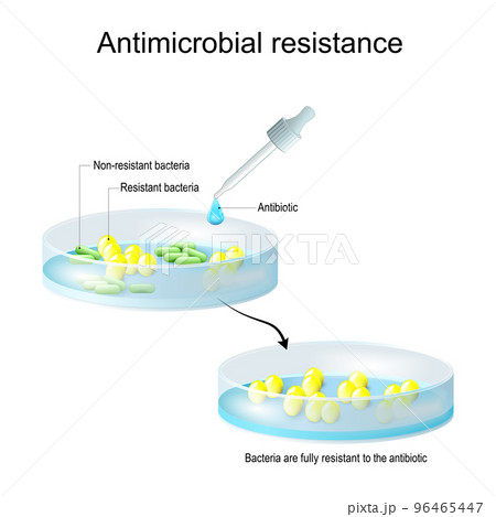Antimicrobial resistance. Pipette with drop of antibiotic, and petri dish with colony of bacteria. 96465447
