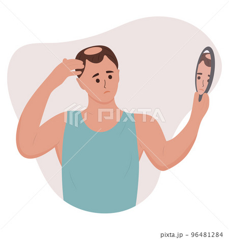 Man looking in the mirror at his baldness. Hair loss, alopecia in young age, hair problems. Vector illustration of a person with disease problems. 96481284