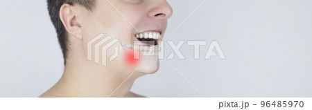 Schematic representation of pain in the jaw. Augmented reality. An x-ray of the jaw bone superimposed on a photograph. Painful areas are highlighted in red. Human bone disease. Osteomyelitis Schematic representation of pain in the jaw. Augmented reality. An x-ray of the jaw bone superimposed on a photograph. Painful areas are highlighted in red. Human bone disease. Osteomyelitis 96485970