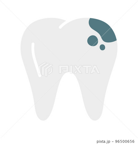 Tooth decay. Bad tooth. Unhealthy teeth, isolated on white background. Tooth decay. Bad tooth. Unhealthy teeth, isolated on white background. 96500656