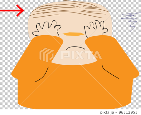 頭髮稀疏的人的插圖 頭髮稀疏的人的插圖 96512953