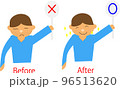 髭脱毛のビフォーアフター	 96513620