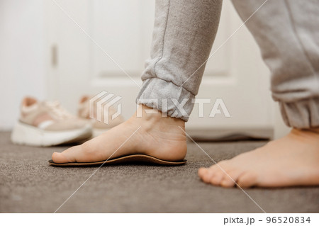Flat feet diagnosis and orthotics, shoe inserts. Problems with flatfoot, pain. Identification of flat foot. Treatment to plantar fasciitis. Womans foot and insoles at home, close up view. 96520834