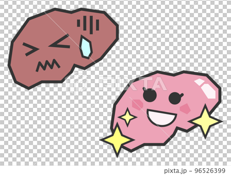 健康な膵臓と病気で不健康な膵臓のイラスト 健康な膵臓と病気で不健康な膵臓のイラスト 96526399