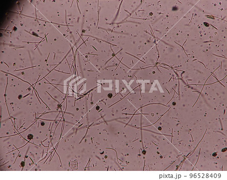 淡水中のたくさんの生物 96528409