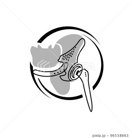 medical orthopedic bone implants logo design vector illustration medical orthopedic bone implants logo design vector illustration 96538663