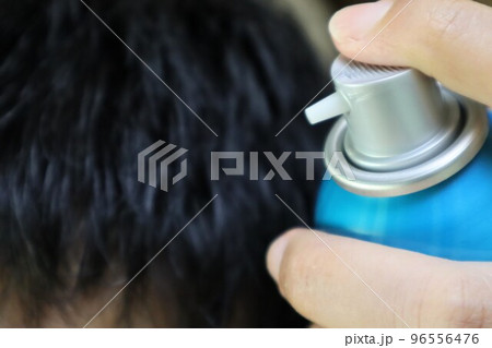 育毛剤を使う人物 96556476