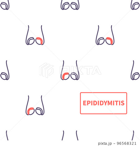 Epididymitis disease of testicles anatomy medical pattern 96568321