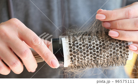 Female hands holding round shaped comb with hair loss Female hands holding round shaped comb with hair loss 96575111