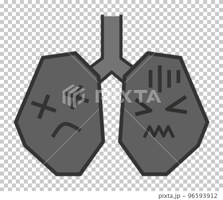 健康診断で病気が発見された不健康な肺のイラスト 健康診断で病気が発見された不健康な肺のイラスト 96593912