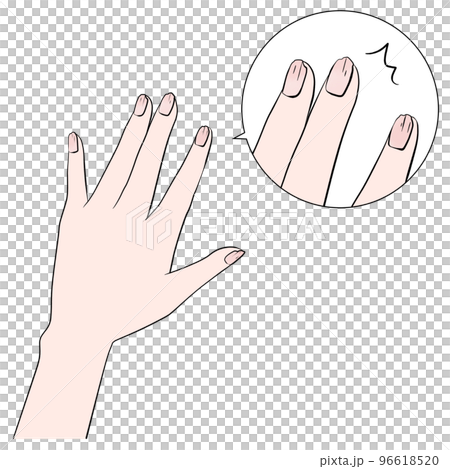 Illustration of a damaged nail (enlarged) anime painting 96618520